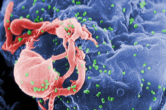 Hình ảnh dưới kính hiển vi của vi rút HIV 