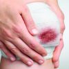 Huyết thanh uốn ván tác dụng bao lâu? Khi nào tiêm uốn ván?